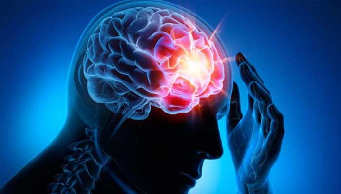 Epilepsi Nedir? Epilepsi Hakkında Bilinmesi Gerekenler