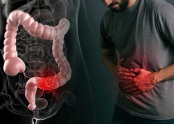 Kabızlık Nedir? Nasıl Geçer?